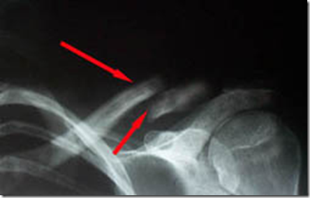 All About Bones